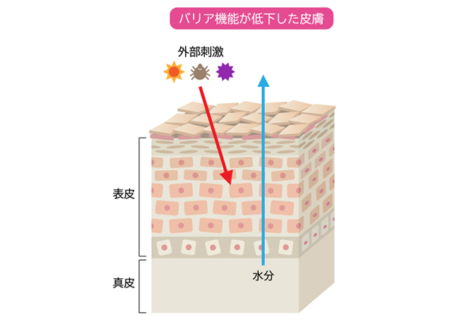 バリア機能の低下